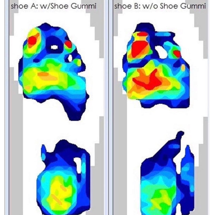 SHOE GUMMI BUNDLE BLACK